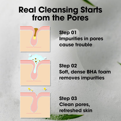 SOME BY MI – AHA, BHA, PHA 30 Days Miracle Acne Clear Foam (50ml)